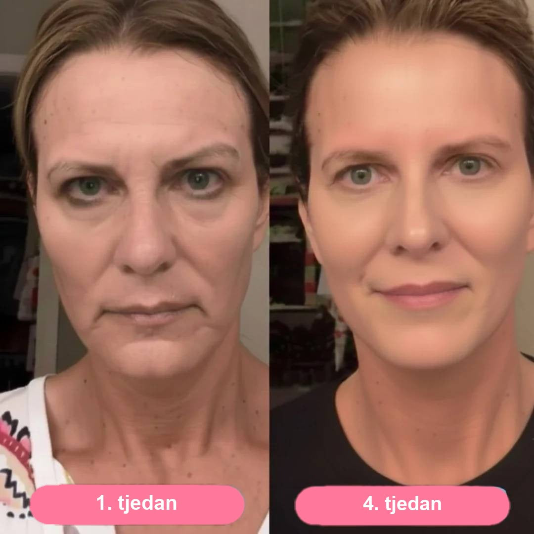Prije / poslije